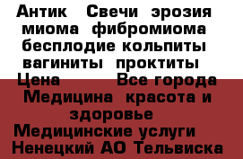 Антик.  Свечи (эрозия, миома, фибромиома, бесплодие,кольпиты, вагиниты, проктиты › Цена ­ 550 - Все города Медицина, красота и здоровье » Медицинские услуги   . Ненецкий АО,Тельвиска с.